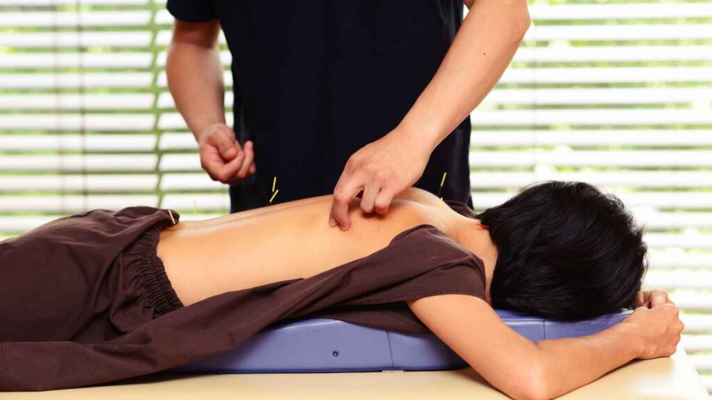 paciente recibiendo acupuntura en espalda de manera indolora por profesional certificado